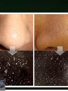 10pzs Mascarilla negra para puntos negros, mascarilla de carbon activado, mascarillas coreanas SINO - Negro - Ver 2