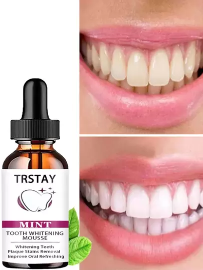 5ML/15ML/30ML/50ML/RtopR 牙齿美白牙菌斑去除剂牙齿清洁去除污渍美白牙齿口腔卫生牙膏美白慕斯
