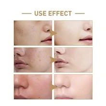 150毫升大米精华爽肤水 - 蕴含大米提取物和烟酰胺，保湿、丰盈、滋养肌肤，男女皆宜 - 白色 - 查看 5