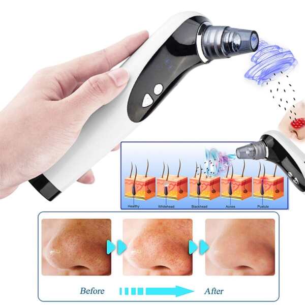 Deep cleaning of facial pores, electric rechargeable vacuum suction