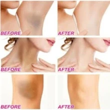 Crema Aclarante Natural Para Axilas y Áreas Sensibles - Blanco - Ver 5