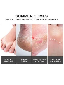 5/10片足膜深層滋潤去角質軟嫩寶寶腳角質去除足膜薰衣草蘆薈膠男女均可使用 - 紫色 - 查看 4