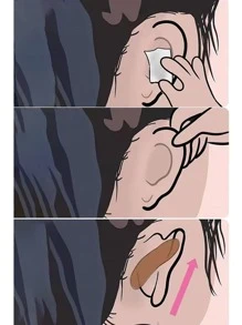 Elf Ear Stickers/ear Correction Supporter/ear Shaper For Photography - 1 Sheet (6pcs) - Clear - View 3