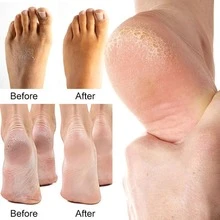 FATAZEN 1 pair foot nail mask Skin care moisturizing foot mask gloves  of whitening collagen repair spa exfoliating gloves sheets  foot nail mask - Pink - View 3