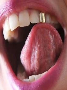 1 Pieza De Brackets Dentales Con Dientes Puntiagudos En Negro - Negro - Ver 3