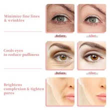 2 Stück/Set Gesichts-Schönheits-Eisgloben, Kühlkugeln, Massagetool zum Straffen der Haut, Reduzieren von Falten und Schwellungen, Anti-Aging, Geschenk für Frauen, Schönheit, Hautpflege Produkte, Spa, Selbstfürsorge, Hautpflegewerkzeuge, Gesichtspflege, Ästhetik-Zubehör, Massage, Gesichtsmassage-Tool, Gesichtsroller - Gelb - Übersicht 5