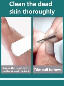 件不銹鋼足部修腳刀、腳銼去除趾甲、足部護理工具、去除死皮癒傷組織刀刮修腳癒傷組織去除器修腳清潔器工具男式女式足部護理修指甲、指甲槽和灰指甲、內生指甲厚硬指甲問題，指甲修復工具 - 銀色 - 查看 3