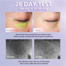 視黃醇彈性眼霜至減少眼袋,精細的,黑暗的界,保濕,,修復和抗皺紋 - 視黃A醇賦彈眼霜 - 查看 6