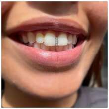 1pc Sparkling Cubic Zirconia Single Grillz for Women - Iced Out Teeth Accessory - Silver - View 3