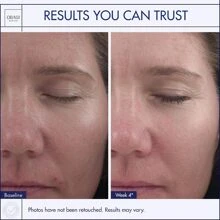 OBAGI MEDICAL Obagi360 Retinol 0.5 1oz (28 g) - Advanced Anti-Aging Treatment - Reduces Fine Lines, Wrinkles - Enhances Skin Texture and Tone - Time-Released Retinol for Maximum Benefit - Dermatologist-Recommended for All Skin Types
