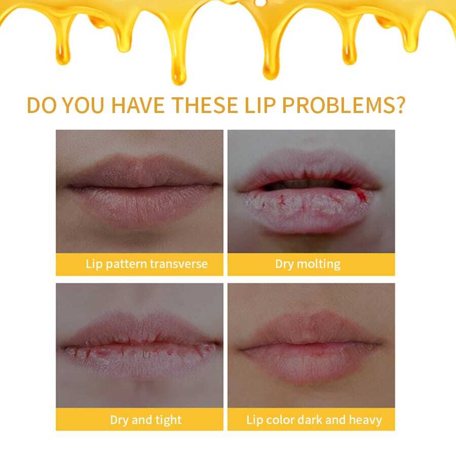 Honey Lip Balm For Women, Lip Care Product With Moisturizing