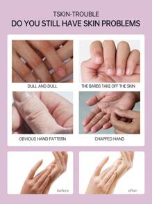 MCHOIX 5入組手霜禮盒,含有玻尿酸、煙酰胺、維生素e,深層滋潤和保護手部肌膚,預防乾燥和龜裂,旅行便攜型保濕霜,適用於媽媽、女孩、妻子、祖母 - 彩色 - 查看 2