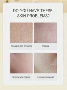 5ml/15ml/30ml/50ml/trstay必需油洋甘菊舒緩肌膚褪色,消炎抗痘效果 - 彩色 - 查看 6