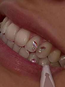 1 Box Of Pink Y2k Butterfly Tooth Gems