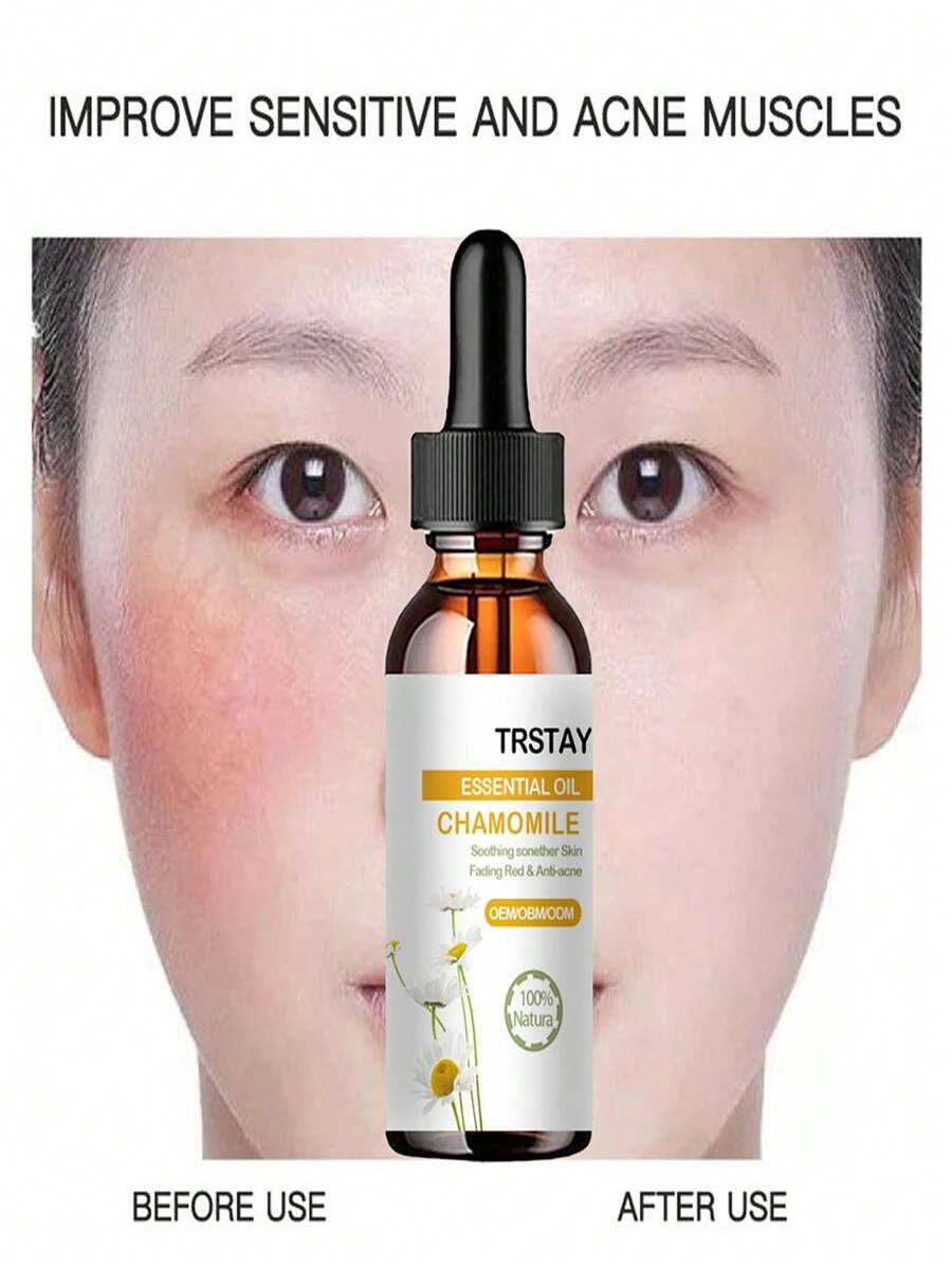 5ml/15ml/30ml/50ml/trstay必需油洋甘菊舒緩肌膚褪色,消炎抗痘效果 - 彩色 - 查看 1