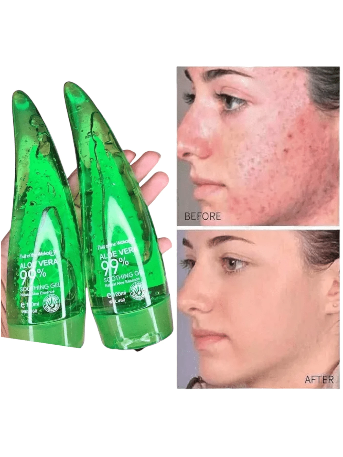 Gel Aloe Vera Hidratante Facial  & Corporal 120 ML - Verde - Ver 1