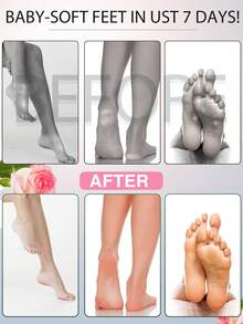 玫瑰足膜去角質死皮，去角質保濕，適合乾燥、龜裂的腳，讓腳變得柔軟光滑（2袋/4片） - 玫瑰紅 - 查看 3