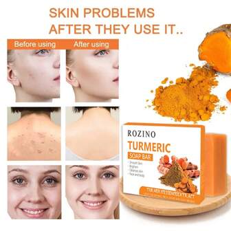 Jabón De Cúrcuma De 100g: Limpieza Facial Y Corporal, Tono De Piel Más Brillante, Limpieza Profunda, Piel Suave Y Clara, Adecuado Para Todo Tipo De Piel Con Ingredientes Naturales