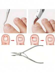 2pcs/set Ingrown Toenail Clippers Foot Care Tools - White - View 9