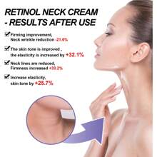1 Pieza Crema Para El Cuello De Retinol De 40g - 1 palo - Ver 3