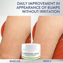 GZE妊娠纹霜，肌肤柔滑霜，淡化产后肥胖纹和生长纹，蕴含乳木果油