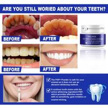 1入裝30g激活牙齒美白粉,白色,去除牙齒變黃和污漬,清潔口腔和清新呼吸 - 白色 - 查看 3