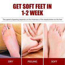 1入組果酸去角質足膜,刪除死皮&老繭,保濕和滋養,足療治療 - 紅白色 - 查看 3