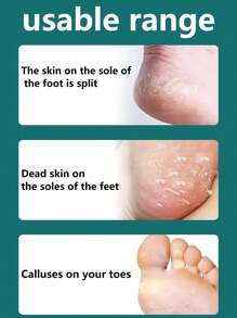 Stainless Steel Pedicure Scrapers Callus Knife Pedicure Scrubber Tools Foot File Dead Skin Remover Tools Pedicure Tool - Silver - View 2