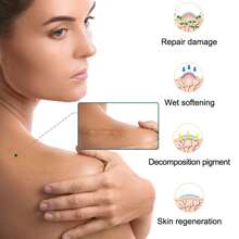 1 Box 3 Meter Self-adhesive Silicone Gel Sheet For Scars - Brown - View 6