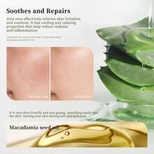 SHE LOVES Bálsamo Calmante Aloe Revital - Hidratación Profunda, Cuidado De La Piel Nutritivo Después Del Sol Para Cara, Cuerpo Y Cabello - Quemaduras Solares, Enrojecimiento
