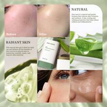 SHE LOVES Bálsamo Calmante Aloe Revital - Hidratación Profunda, Cuidado De La Piel Nutritivo Después Del Sol Para Cara, Cuerpo Y Cabello - Quemaduras Solares, Enrojecimiento