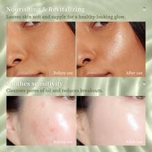 SHE LOVES Bálsamo Calmante Aloe Revital - Hidratación Profunda, Cuidado De La Piel Nutritivo Después Del Sol Para Cara, Cuerpo Y Cabello - Quemaduras Solares, Enrojecimiento