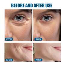 益生菌濃縮抗皺精華液,減淡魚尾紋、嘴角紋,保濕緊緻肌膚 - 藍色 - 查看 3