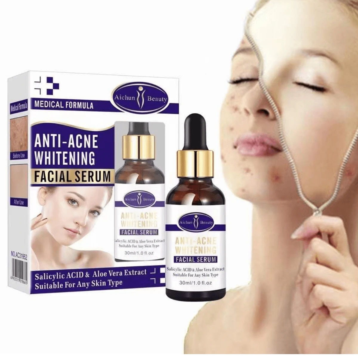 Serum  Anti Acné Piel Delicada Puntos Anti-manchas 30ml con extracto de aloe vera y acido salicilico - transparente - Ver 1