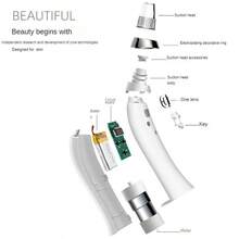 Binzim 電動黑頭清除器，使用微晶清潔頭清潔毛孔，並提升肌膚緊實度 - 白色 - 查看 5