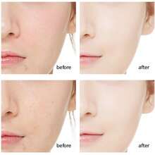 Crema Facial Hidratante De Ácido Hialurónico Reparadora De Piel, Adecuada Para Todos Los Tipos De Piel. Absorción Rápida Y Efectiva Que Restaura La Piel A Un Estado Saludable - 30g - Ver 4