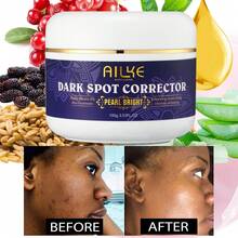 Ailke去除黑斑護手霜,適用於腋下、肘部、腿部、老年斑、太陽斑和雀斑,含穀胱甘肽和維生素e