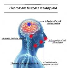 1pc Sports Mouthguard Suitable For Boxing, Football, Basketball, Taekwondo, Volleyball, Teeth Protector