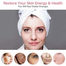 Facial Skin Care Led Photon 5 Colores FA Radiofrecuencia LED Photon Therapy Masaje Facial Lifting Facials - Rosa - Ver 6