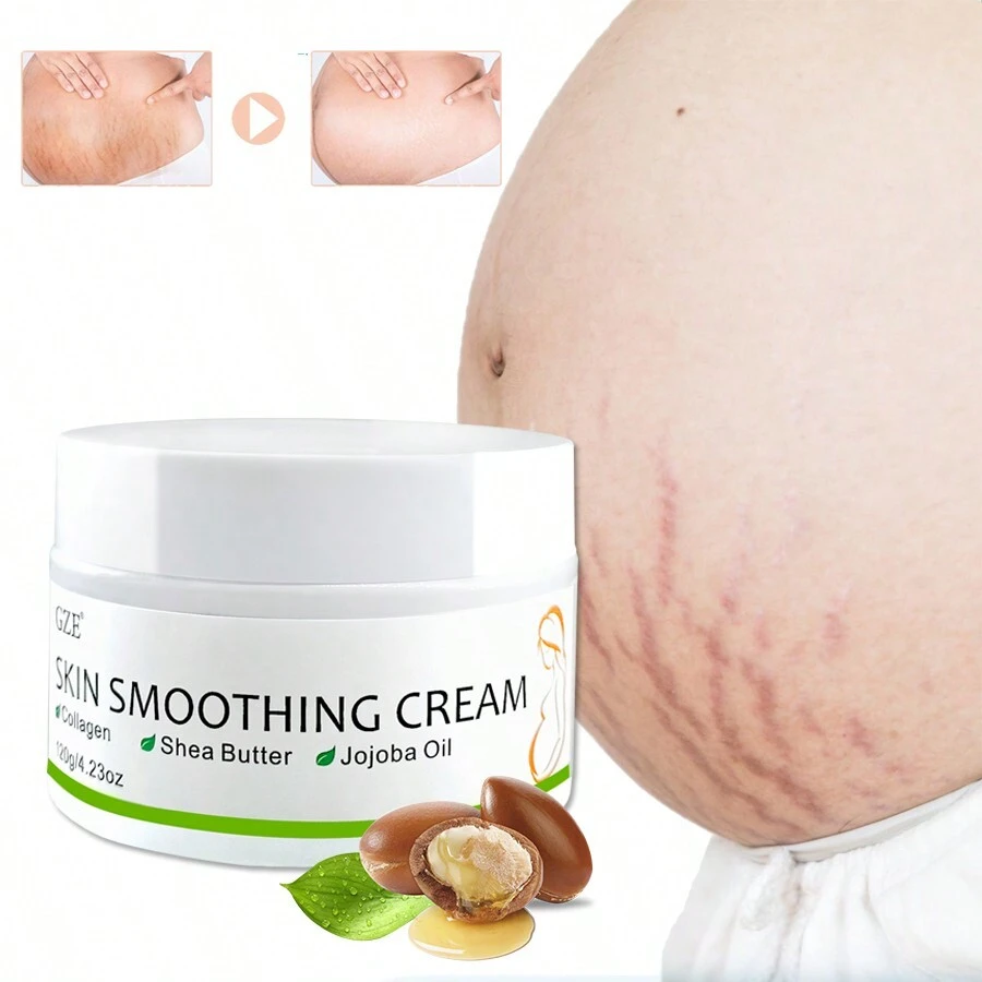 1 pieza Crema para las estrías que mejora y suaviza la piel - Blanco - Ver 1