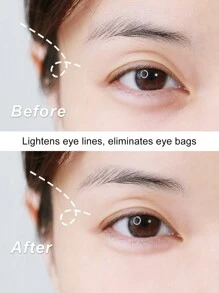 1pair Reusable Silicone Eye Mask, Anti-wrinkle And Anti-aging Wrinkle Patch - Pink - View 2