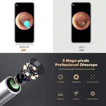 BEBIRD X17 Pro Ear Wax Removal Camera Endoscope, All Aluminum Body H-Speed WiFi 6 Axis Intelligent Gyroscope Safe Professional 1080p Smart Visual Ear Cleaner With Camera For Kid Adult PetSPP-Global-Pro-US