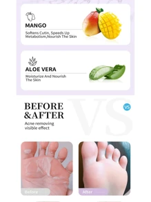 Mascarilla Exfoliante Para Pies: Ultimate Foot Care Solution - Natural, Moisturizing, and Soothing Exfoliante Para Pies - Transforms Dry, Cracked Feet into Soft, Smooth Beauties - Perfect Self-Pedicure at Home! - Rosa - Ver 6