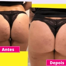 kit 3 Creme  Firmador De Bumbum Gel Massageador Para Celulite Estria Flacidez Queimador de Gorduras - Firmador de Bumbum - Visão 3