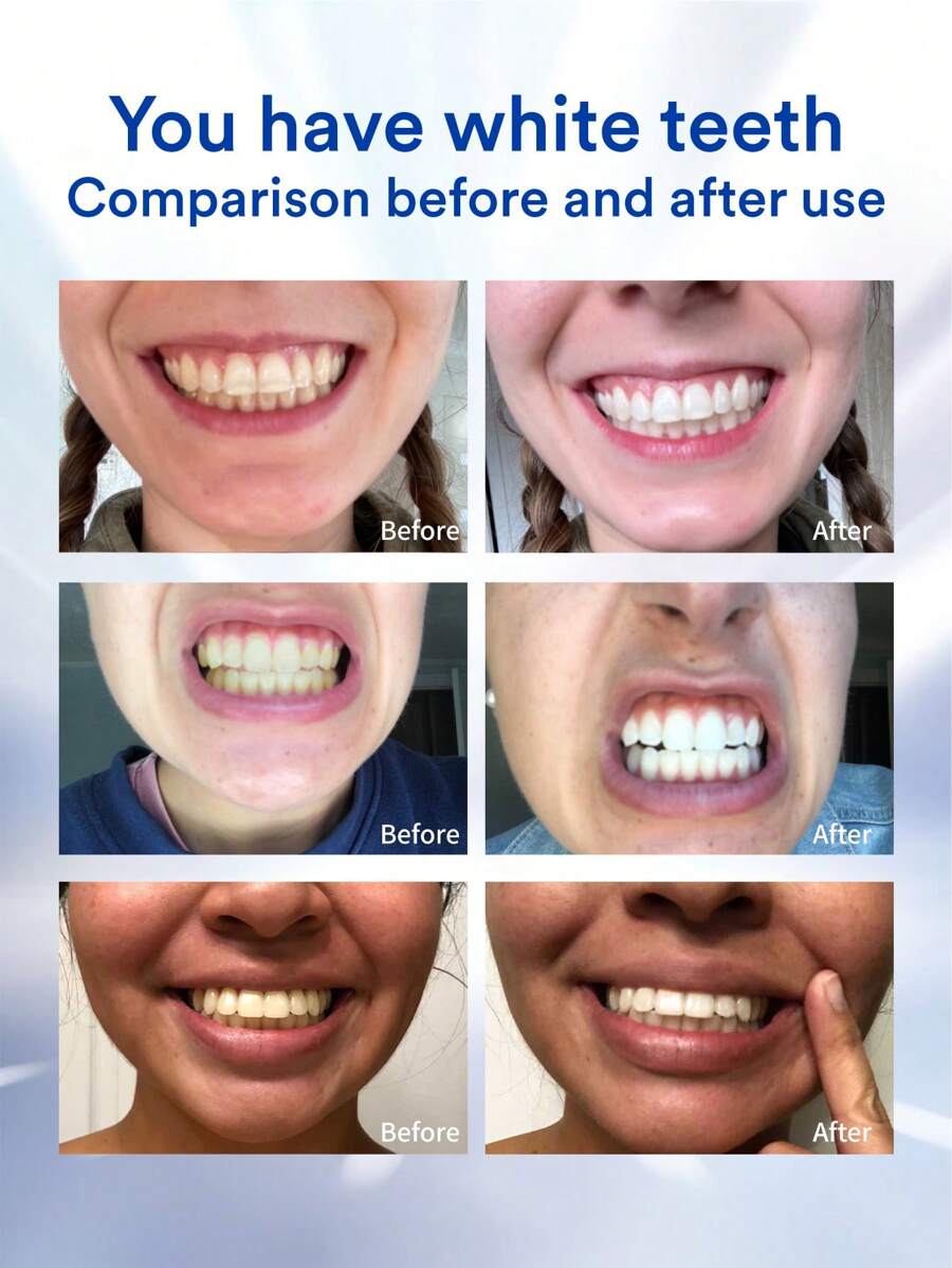 Hismile PAP+ Whitening Strips SensitivityFree Teeth Whitening ,Remove