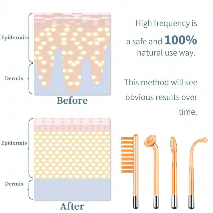 High Frequency Facial Machine TUMAKOU Portable Handheld High