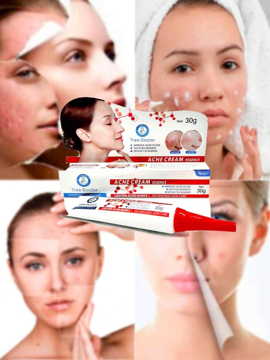 Tree Doctor Esencia De Crema Acne Crema Anti Acné Control De Grasa Piel Quita Manchas Provocadas Por El Acne - Blanco - Ver 1