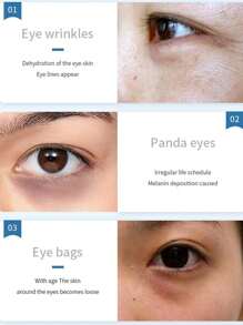 10 Pares De Parches Para Ojos Con Colágeno Que Ayuda A Desvanecer Las Ojeras Y Desinflamar Hidratante - Albaricoque - Ver 5