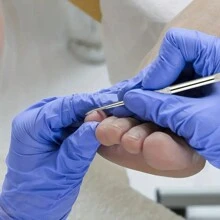 Bộ 3 dụng cụ làm móng chân mọc ngược bằng thép không gỉ, giũa móng chân và dụng cụ nâng móng chân, bộ dụng cụ làm móng phẫu thuật chuyên nghiệp, dụng cụ làm sạch móng, dụng cụ giảm đau - Bạc - Xem 3