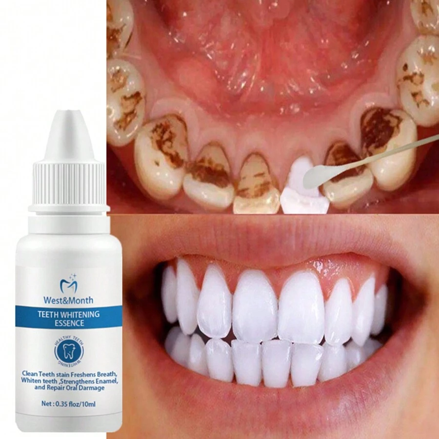 10ml去除牙菌膜污漬牙齒美白潔齒液 - 白色 - 查看 1